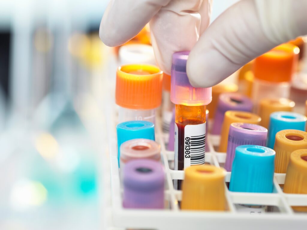 Laboratory technician preparing blood sample for medical testing in laboratory; Shutterstock ID 397825687; PO: N/A